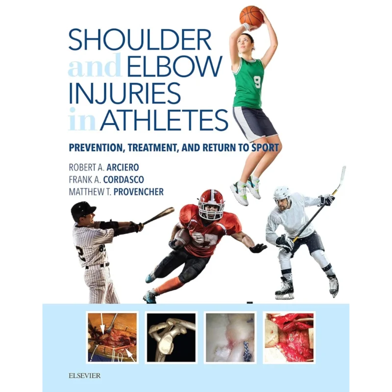 Shoulder and Elbow Injuries in Athletes: Prevention, Treatment and Return to Sport