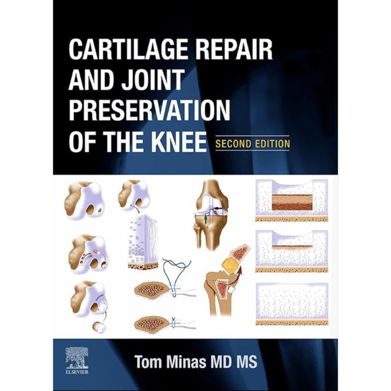 Cartilage Repair and Joint Preservation of the Knee