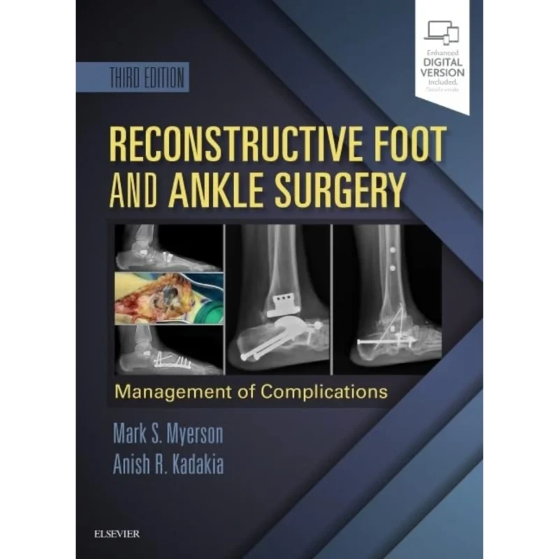 Reconstructive Foot and Ankle Surgery: Management of Complications