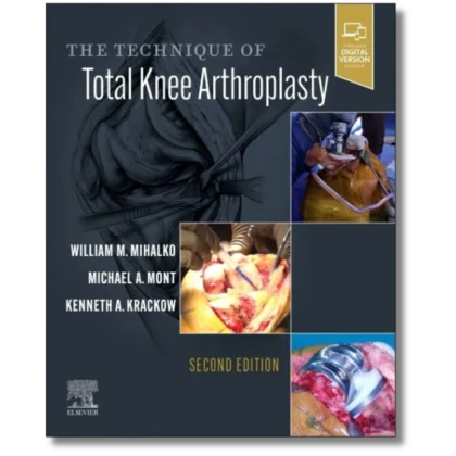 The Technique of Total Knee Arthroplasty