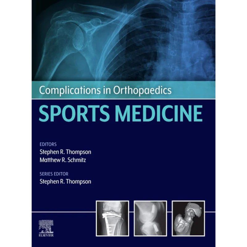 Complications in Orthopaedics: Sports Medicine