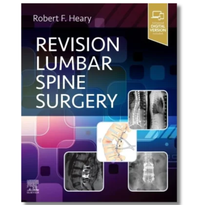 Revision Lumbar Spine Surgery