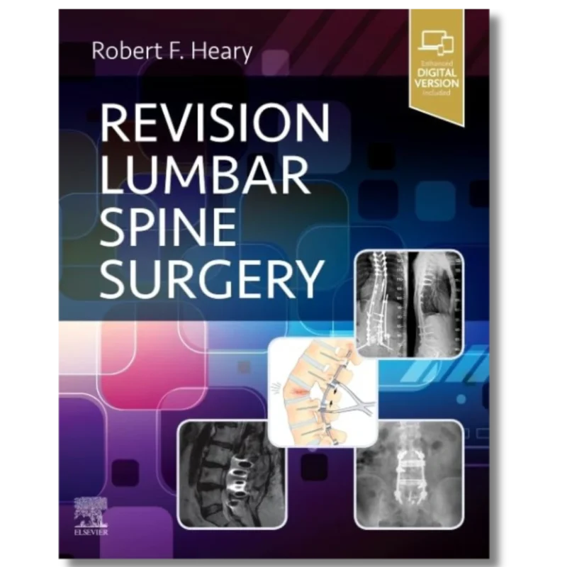 Revision Lumbar Spine Surgery