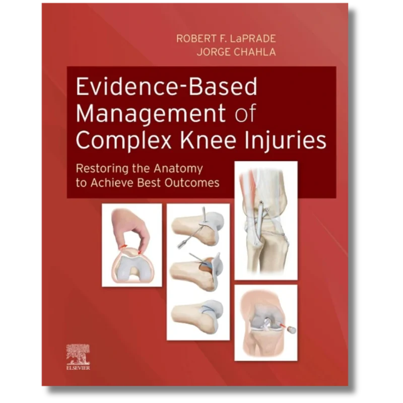Evidence-Based Management of Complex Knee Injuries: Restoring the Anatomy to Achieve Best Outcomes